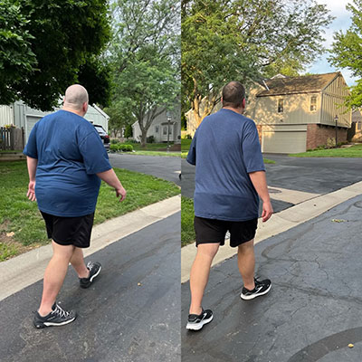 Jason Purinton walks through his neighborhood in both images, showing him before and after weight loss surgery.