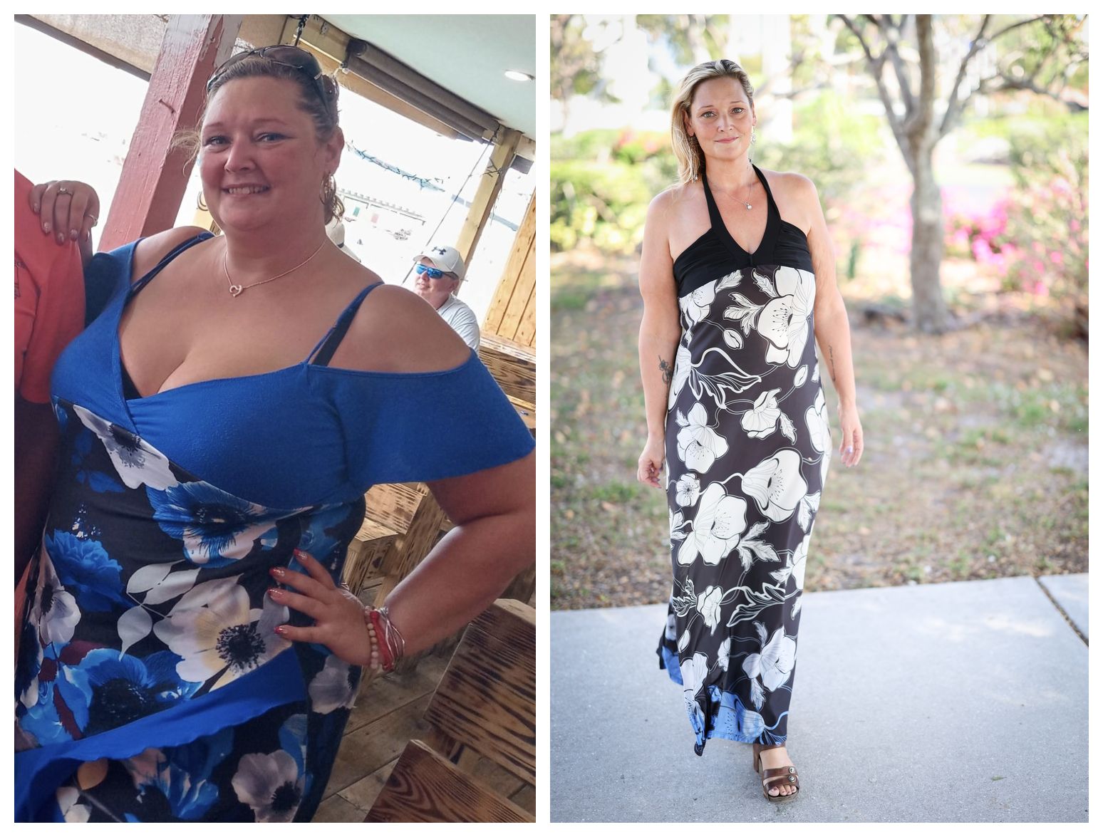 Patient s weight loss journey inspires ambition and will to live