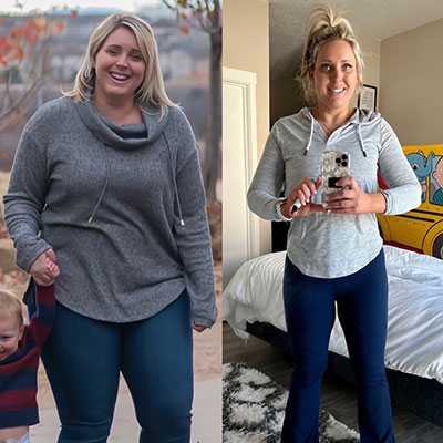 Side-by-side photo of Lindsey Gyger showing her weight loss progress before and after undergoing bariatric surgery.